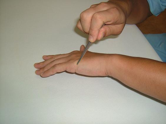 ��k���̎挊�ʐ^